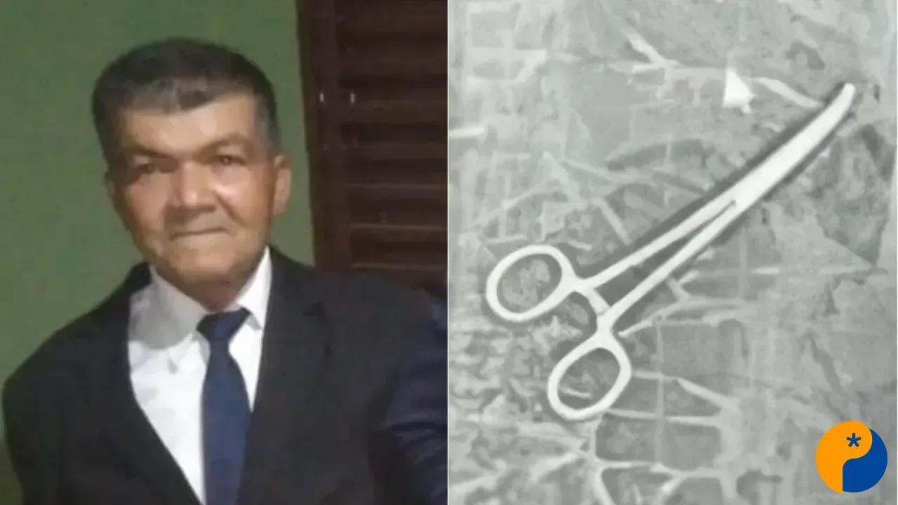 Polícia Civil indicia equipe médica e aponta que pinça esquecida em cirurgia agravou saúde de idoso 