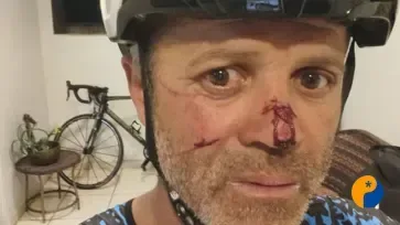 Linha com cerol corta lentes de óculos e fere ciclista em Patos de Minas