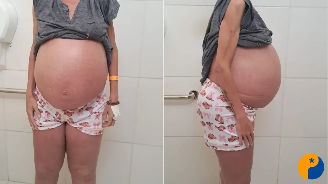 Após mais de um ano de exames e cirurgias, mãe de três filhos busca respostas e aguarda vaga em BH 